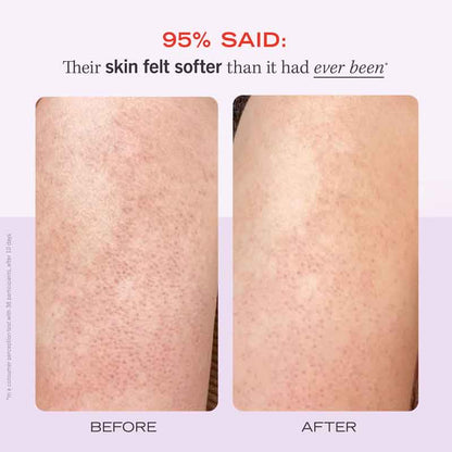 First Aid Beauty KP Bump Eraser Body Scrub Fresh Strawberry