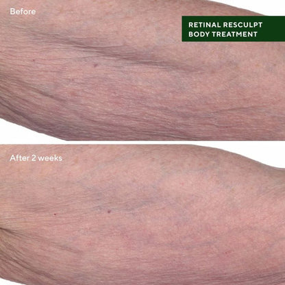 Murad Retinal ReSculpt Body Treatment